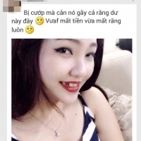 gái xinh bị cướp mất cả răng =))