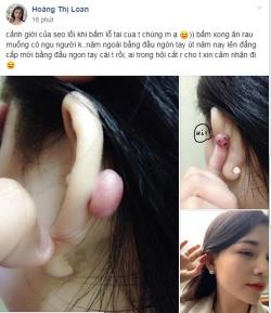 Cô nàng xinh như hotgirl bỗng nhiên xuất hiện 'dị vật' sau tai chỉ vì ăn rau muống