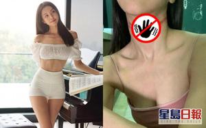 'Bom sex Malaysia' đăng ảnh tự tử thất bại